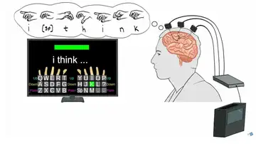Un implante permite teclear con la mente a dos personas con parálisis Un implante permite teclear con la mente a dos personas con parálisis