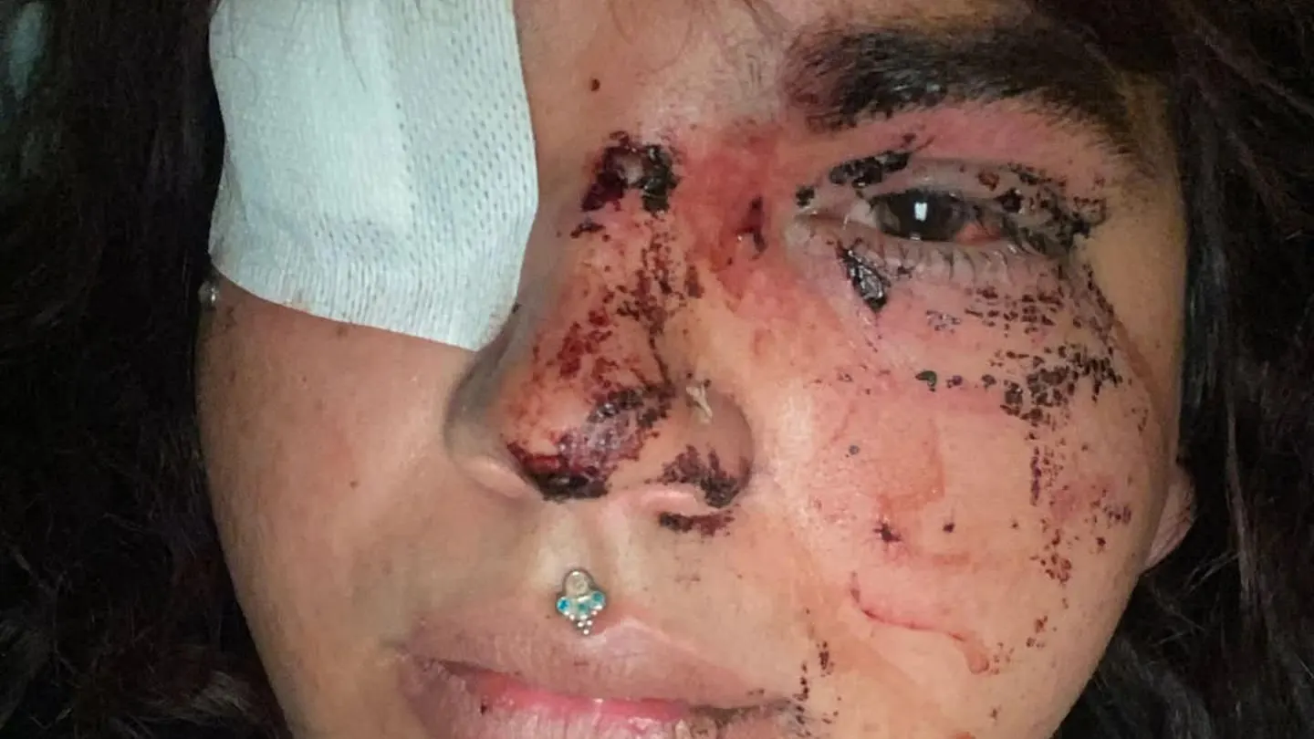 Una mujer transexual sufre una paliza a manos de un grupo de personas en La Bañeza, León Una mujer transexual sufre una paliza a manos de un grupo de personas en La Bañeza, León