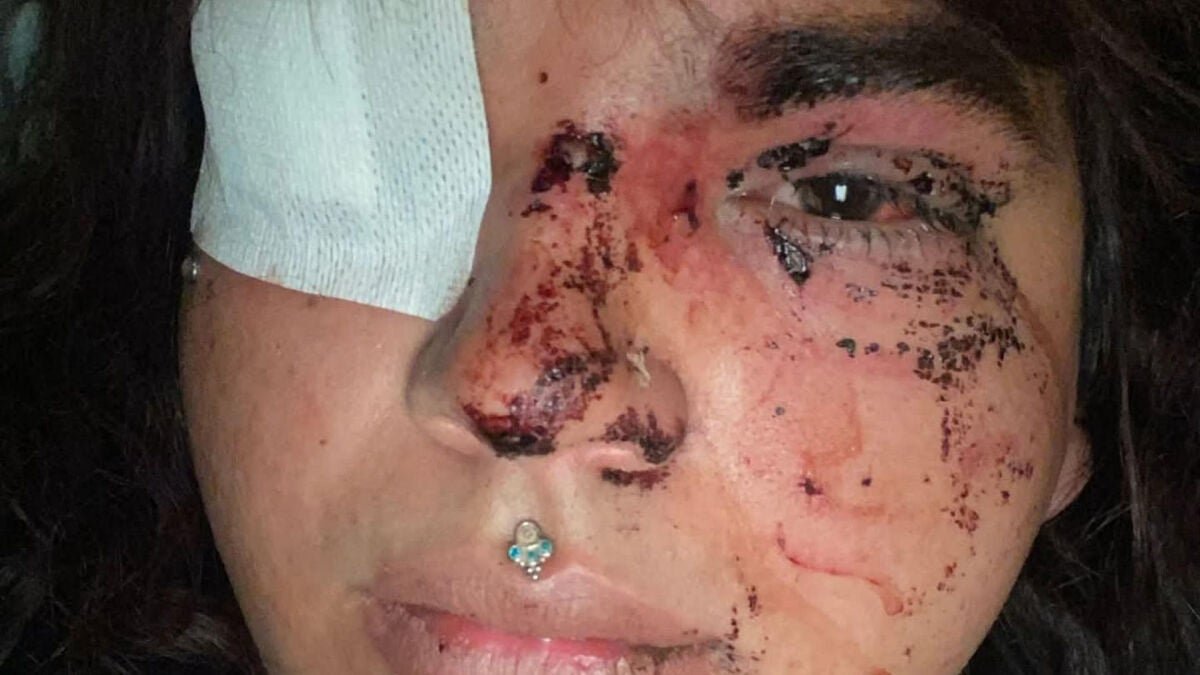 Una mujer transexual sufre una paliza a manos de un grupo de personas en La Bañeza, León