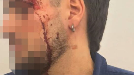 Agresi&oacute;n a un joven