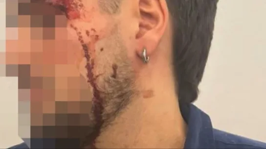 Agresión a un joven Agresión a un joven