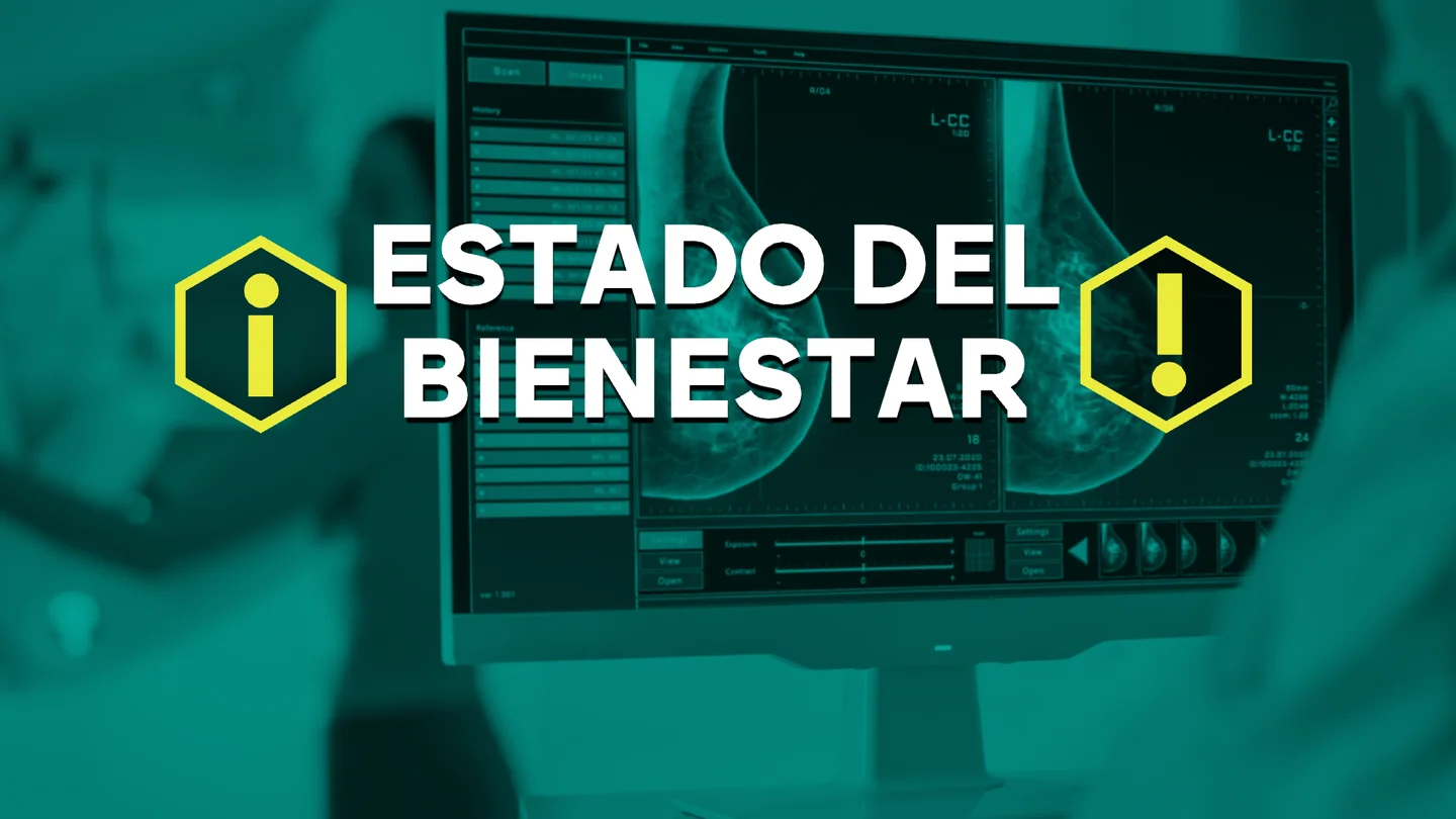 ¿Debería bajar a los 40 años la edad mínima para el cribado del cáncer de mama?: una petición que salvaría vidas ¿Debería bajar a los 40 años la edad mínima para el cribado del cáncer de mama?: una petición que salvaría vidas