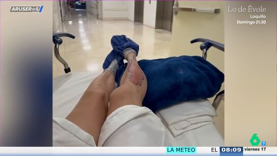 Alfonso Ar&uacute;s reacciona al nuevo susto de Taylor Momsen tras una picadura de animal: "Su sangre debe de tener algo"