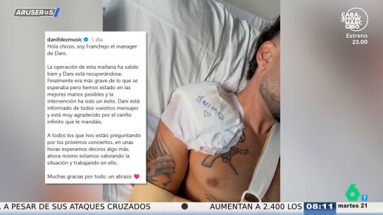 Dani Fern&aacute;ndez informa sobre su estado de salud tras su ca&iacute;da en concierto: "Era m&aacute;s grave de lo que se esperaba"