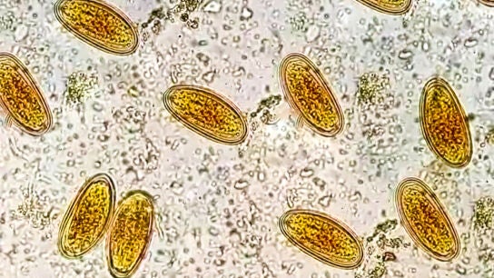 Enterobius vermicularis