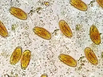 Enterobius vermicularis Enterobius vermicularis