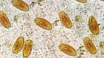 Enterobius vermicularis