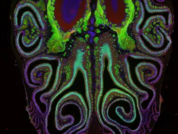 Fotografía microscópica de un corte transversal de la nariz de un ratón Fotografía microscópica de un corte transversal de la nariz de un ratón