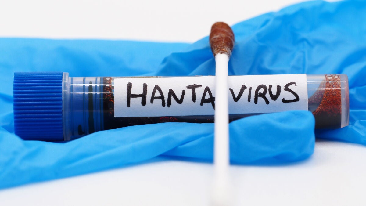Un primer análisis del hantavirus en el ciudadano suizo ingresado descarta mutaciones