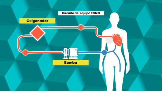 Una bomba centrífuga que oxigena y reintroduce la sangre: así mantienen con vida a la mujer francesa crítica por hantavirus