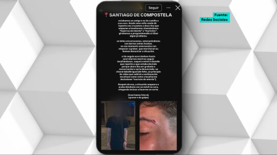 Denuncia una agresi&oacute;n hom&oacute;foba en Santiago de Compostela: patadas, manotazos e insultos como "bujarras de mierda"