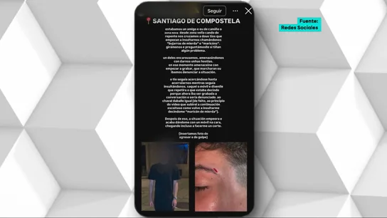 Denuncia una agresión homófoba en Santiago de Compostela: patadas, manotazos e insultos como "bujarras de mierda" Denuncia una agresión homófoba en Santiago de Compostela: patadas, manotazos e insultos como "bujarras de mierda"