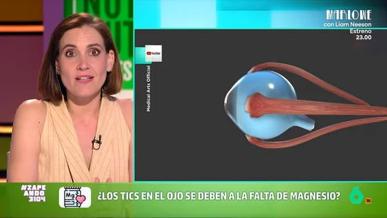 ¿Los tics en el ojo se deben a la falta de magnesio? Boticaria García aclara esta creencia popular La farmacéutica cuenta que esta condición recibe el nombre de mioquimia palpebral y, a pesar de que pueda resultar alarmante, Boticaria expone que "suele ser benigno y es autolimitado".