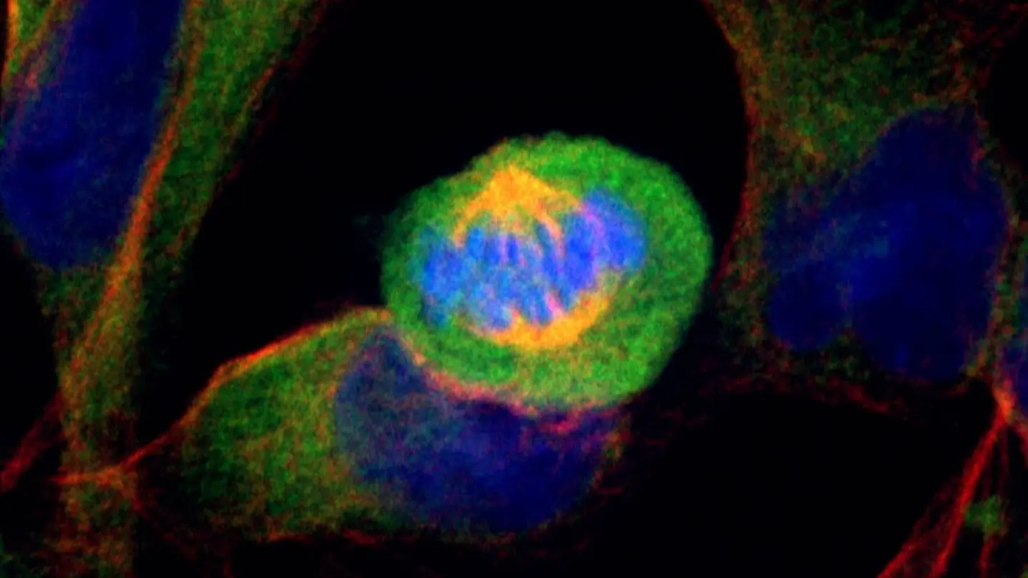 Células de cáncer de páncreas humano en división Células de cáncer de páncreas humano en división