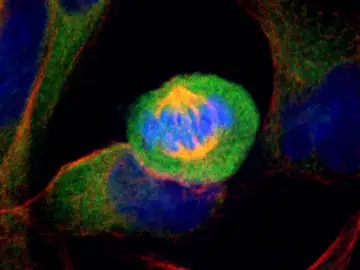 Células de cáncer de páncreas humano en división Células de cáncer de páncreas humano en división