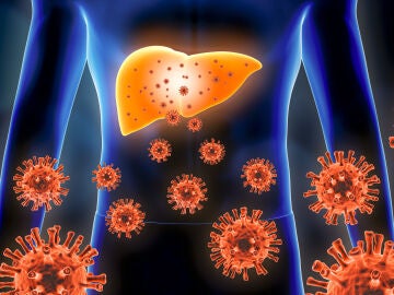 Hepatitis