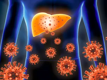 Hepatitis Hepatitis