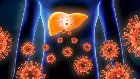 Hepatitis Hepatitis