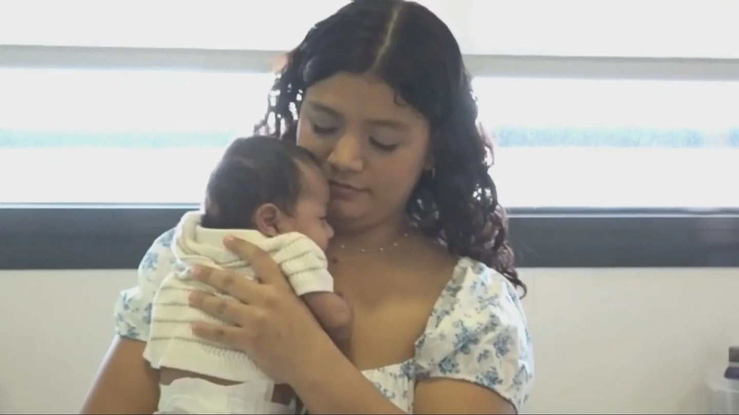 Niño operado de gastrosquisis Niño operado de gastrosquisis