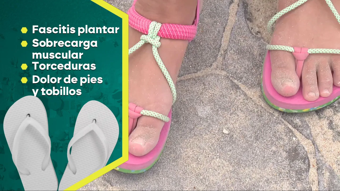 Los peligros de las chanclas de playa como calzado habitual: pueden causar sobrecargas musculares, fascitis plantar y torceduras Los peligros de las chanclas de playa como calzado habitual: pueden causar sobrecargas musculares, fascitis plantar y torceduras