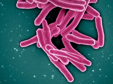 Bacteria de la tuberculosis