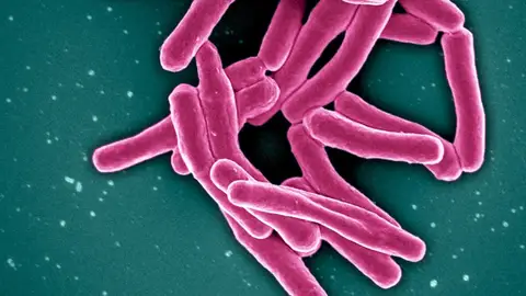 Bacteria de la tuberculosis Bacteria de la tuberculosis