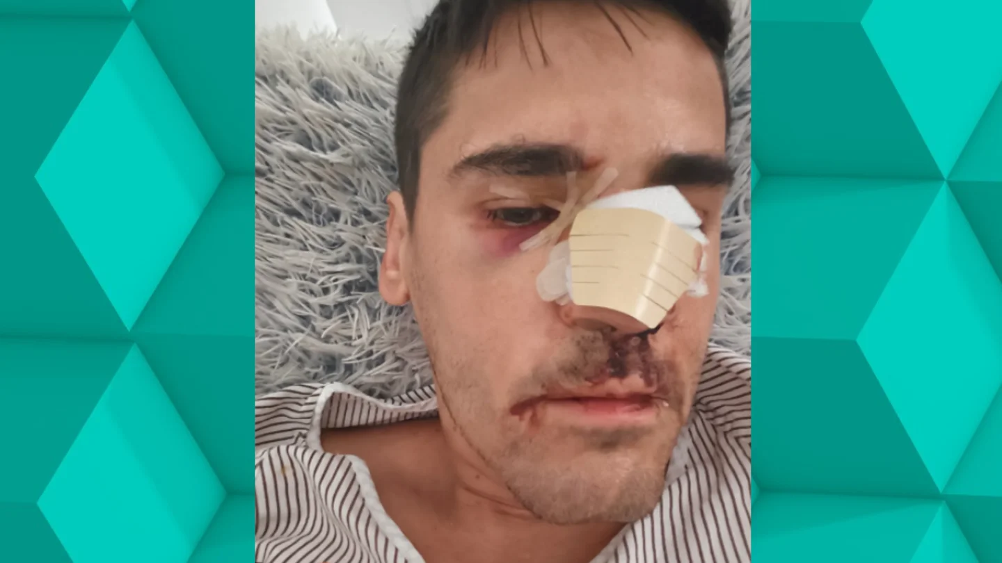 Brutal agresión al periodista Fonsi Loaiza: "Lo último que escuché es que me llamaron 'rojo, subcampeón" Brutal agresión al periodista Fonsi Loaiza: "Lo último que escuché es que me llamaron 'rojo, subcampeón"