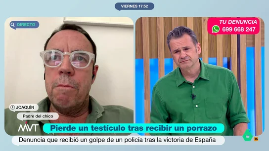 Pierde un testículo Pierde un testículo