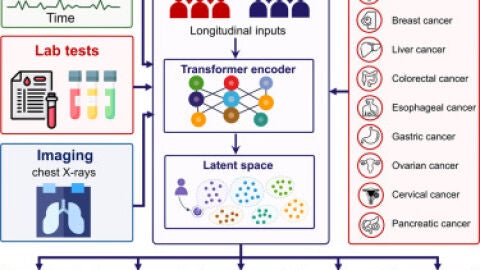 IA Oncoformer