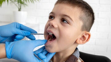 Ni&ntilde;o con caries