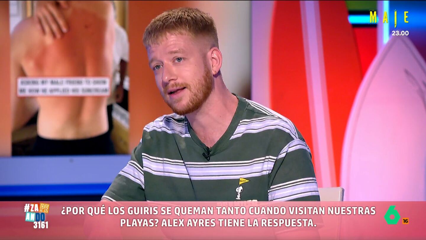 El humorista indica que, en su caso, el quemarse le ha ayudado a ganar dinero. Alex explica que se quem&oacute; justo antes del rodaje de una pel&iacute;cula y el director alab&oacute; la autenticidad de su maquillaje. 