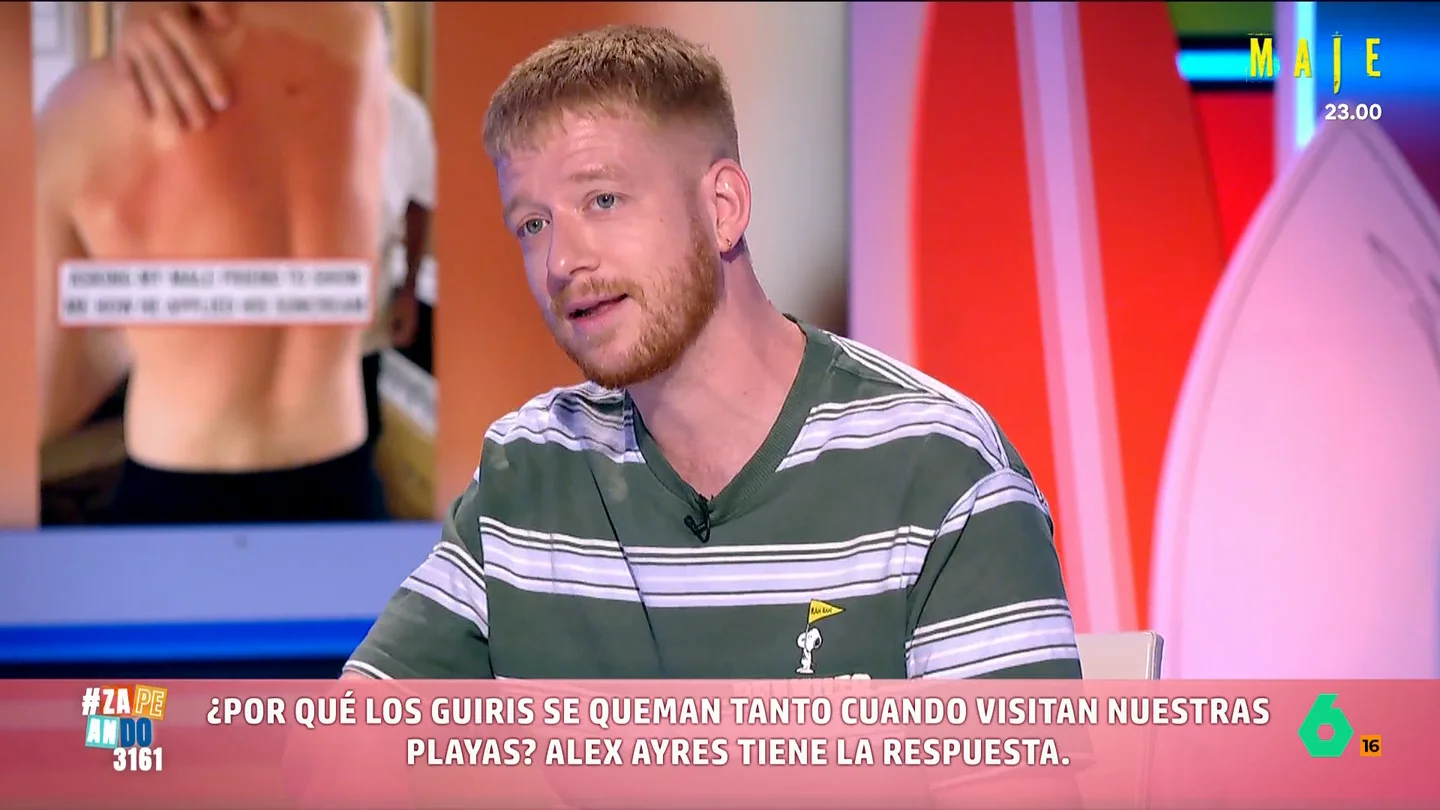 El cómico británico Alex Ayres desvela por qué los extranjeros siempre se queman cuando veranean en nuestro país El humorista indica que, en su caso, el quemarse le ha ayudado a ganar dinero. Alex explica que se quemó justo antes del rodaje de una película y el director alabó la autenticidad de su maquillaje.