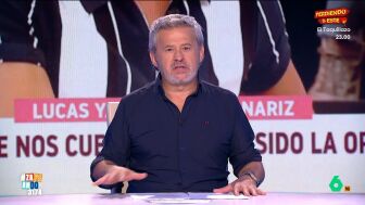 El artista se ha operado en Turqu&iacute;a, tal y como han adelantado en 'Y ahora Sonsoles'. El cantante ha dicho que est&aacute; muy contento con el resultado, pero que la recuperaci&oacute;n va a ser "muy larga, de dos o tres meses".
