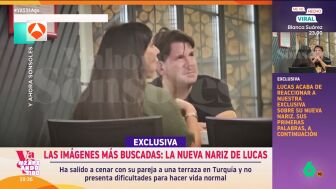 En 'Y ahora Sonsoles' han emitido las primeras im&aacute;genes del artista, 12 d&iacute;as despu&eacute;s de su operaci&oacute;n de nariz. En las mismas se puede ver que la nariz del cantante ya tiene una forma definida. 