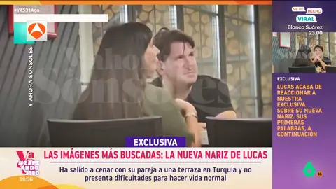 Iñaki Urrutia, tras ver la nueva nariz de Lucas, de Andy y Lucas: "Es un kamikaze..." En 'Y ahora Sonsoles' han emitido las primeras imágenes del artista, 12 días después de su operación de nariz. En las mismas se puede ver que la nariz del cantante ya tiene una forma definida.