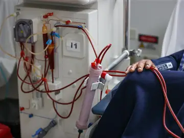 Un paciente en una clínica de diálisis Un paciente en una clínica de diálisis