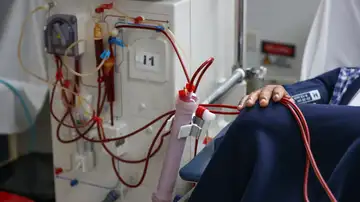 Un paciente en una clínica de diálisis Un paciente en una clínica de diálisis