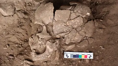 Imagen de uno de los cráneos usados en la investigación Imagen de uno de los cráneos usados en la investigación