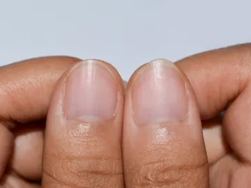 Uñas Uñas