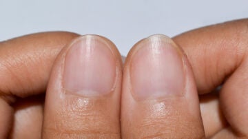 U&ntilde;as
