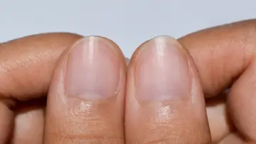 Uñas Uñas