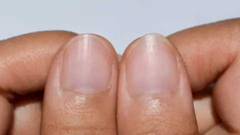 Uñas Uñas