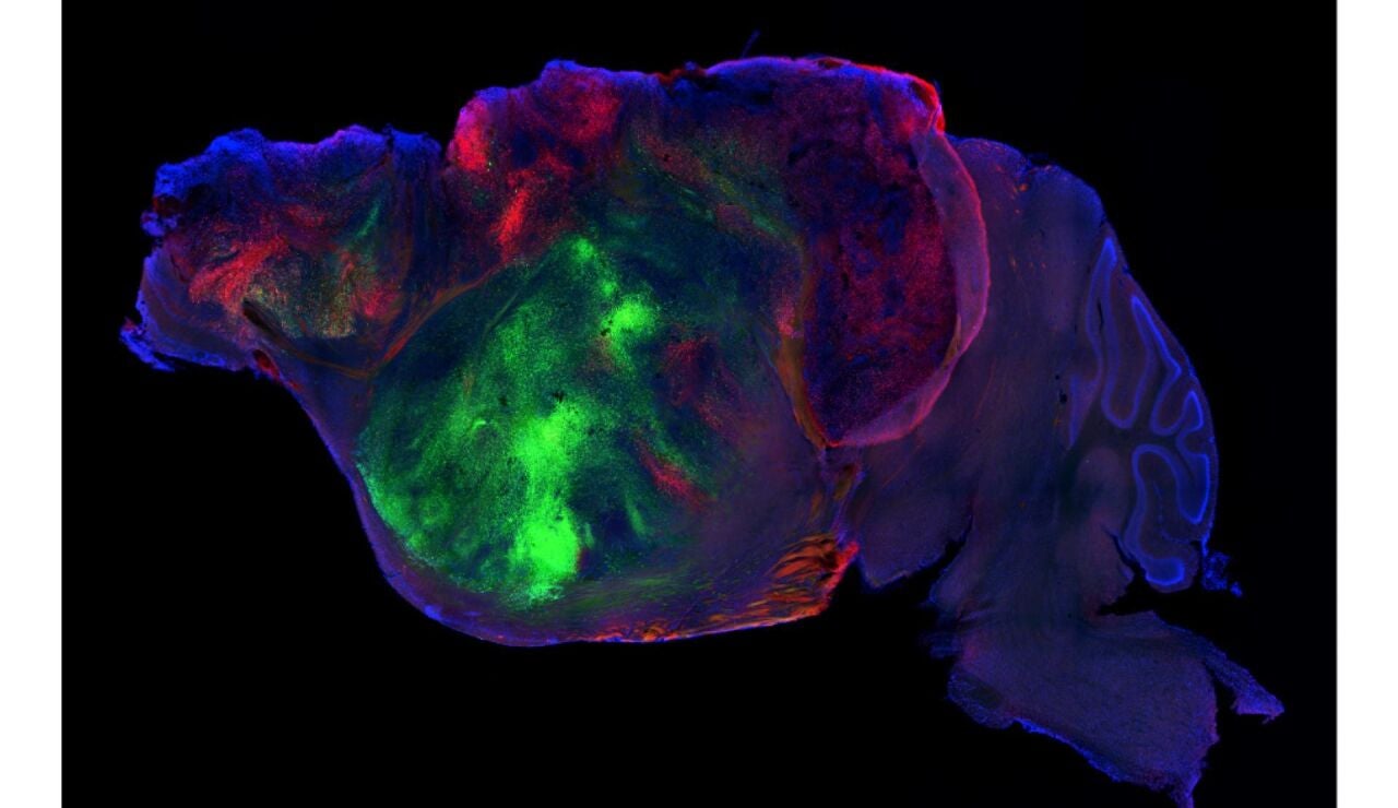Cerebro de rat&oacute;n con xeno-corteza