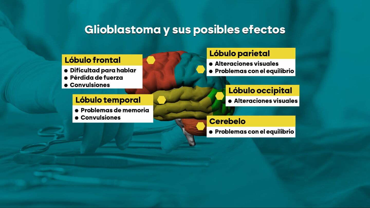Gliobastoma