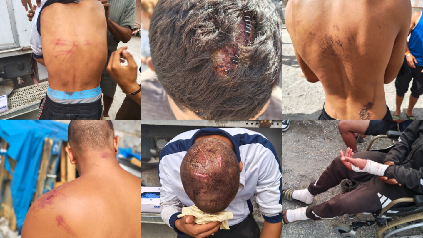"Me pusieron bridas, me amordazaron, me pegaron y me tiraron por un terrapl&eacute;n": Amnist&iacute;a Internacional denuncia torturas de militares a personas migrantes en Ceuta