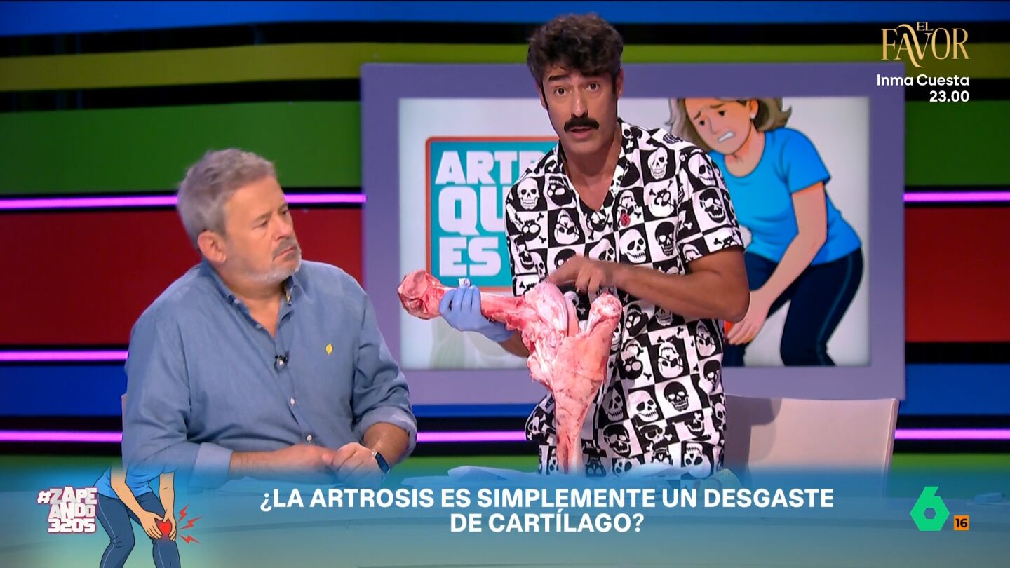 El fisioterapeuta de Zapeando nos muestra, rodilla de vaca mediante, c&oacute;mo se produce la artrosis, qu&eacute; zonas son m&aacute;s proclives a sufrirla y qu&eacute; dicen los estudios y ensayos sobre las mejores formas para mejorar la calidad de vida.