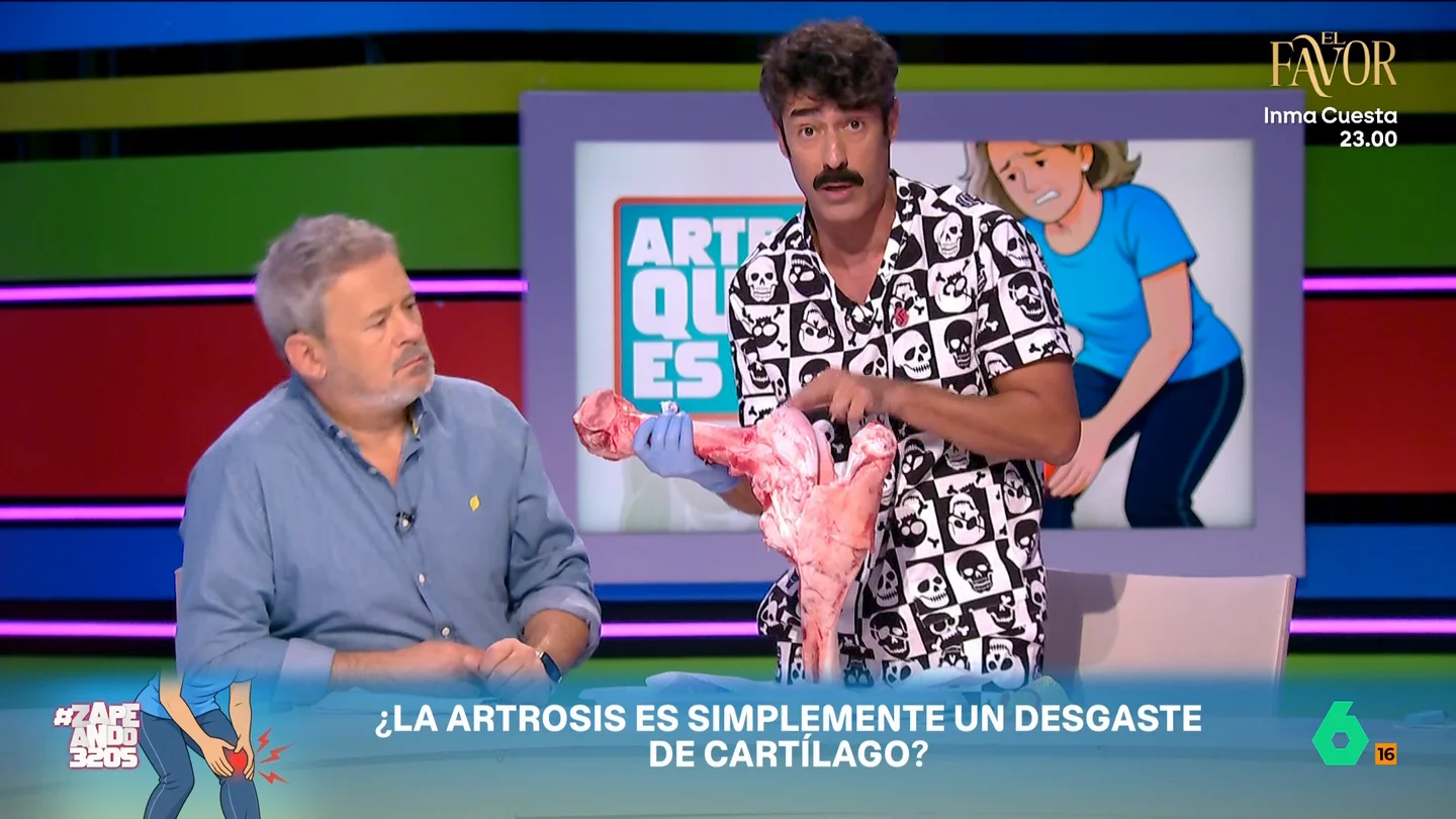 Víctor Hernán lo cuenta todo de la artrosis, en vídeo: cómo se produce, cuáles son sus síntomas y qué hacer para mejorarlos El fisioterapeuta de Zapeando nos muestra, rodilla de vaca mediante, cómo se produce la artrosis, qué zonas son más proclives a sufrirla y qué dicen los estudios y ensayos sobre las mejores formas para mejorar la calidad de vida.