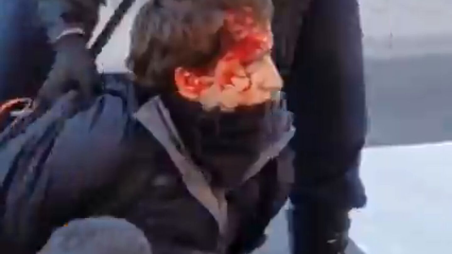 Tres detenidos en las protestas en la Complutense