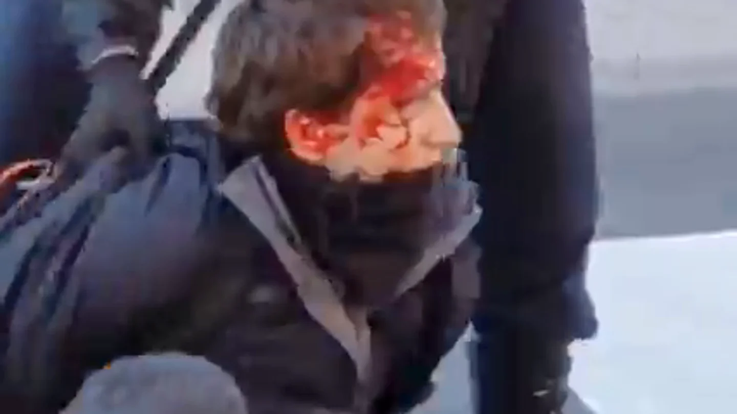Tres detenidos en las protestas en la Complutense Tres detenidos en las protestas en la Complutense