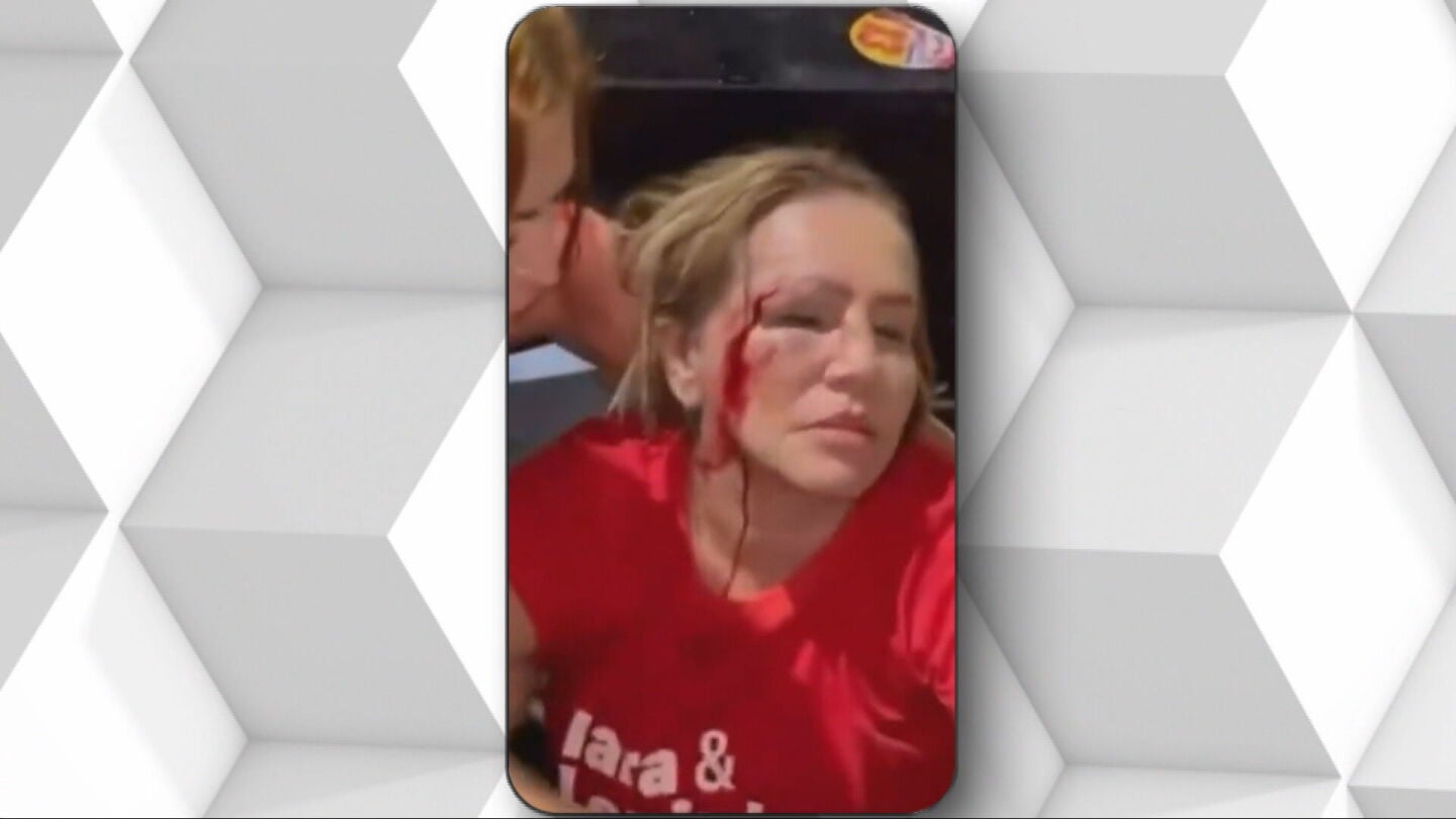 Concejala brasile&ntilde;a atacada